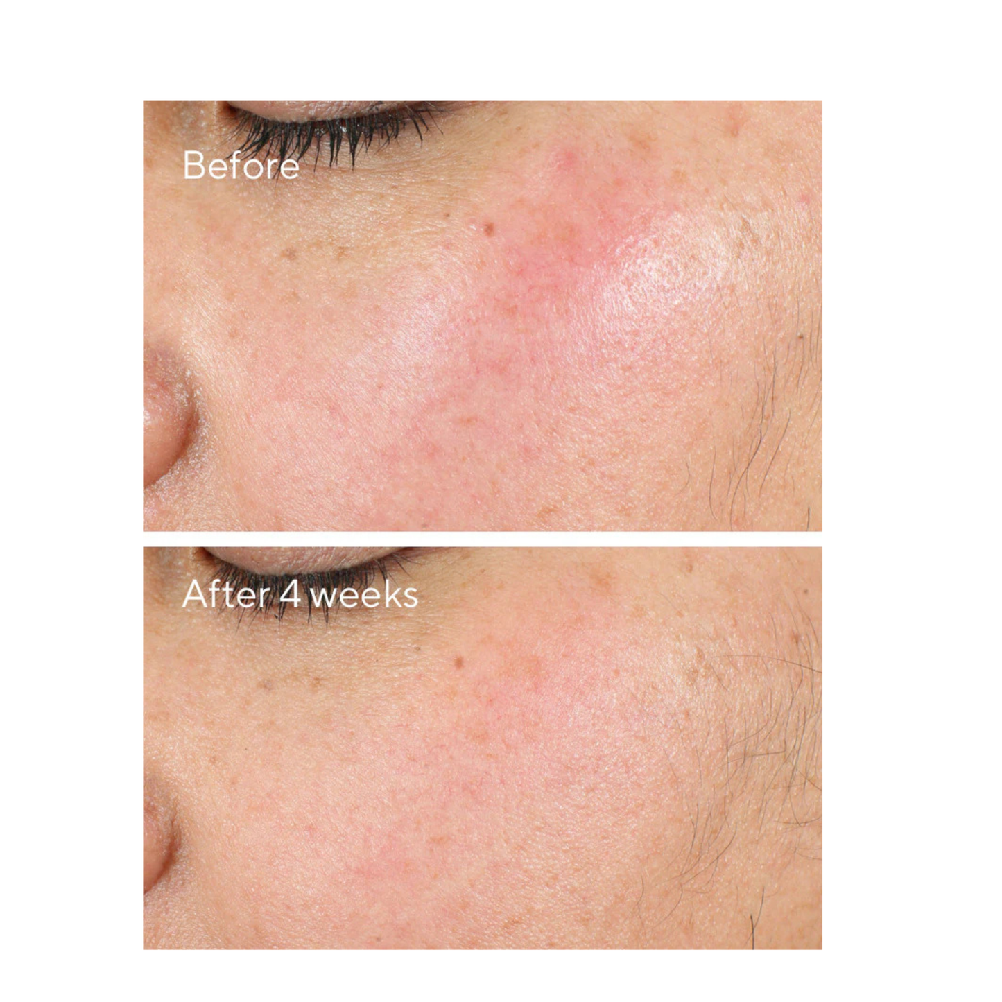 MURAD Intense Recovery Cream 50ml