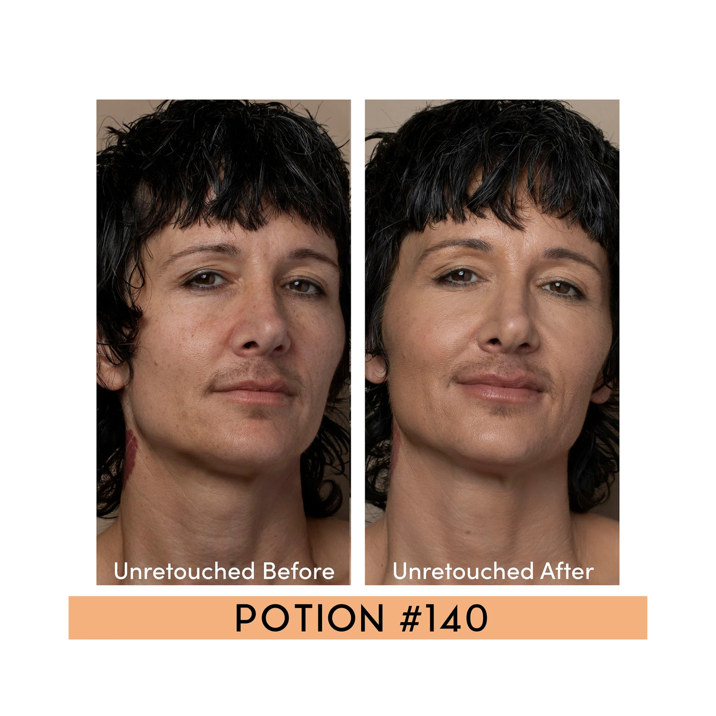 Before and after comparison of a person's face with 'Potion #140' text.